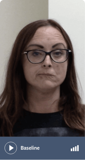 Patient TBD baseline Leah baseline, video